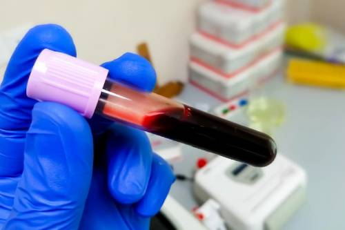 Masood Hospital Blood Bank